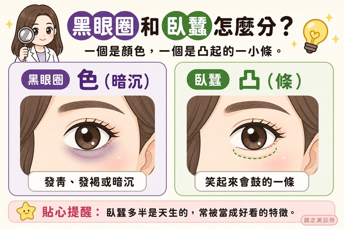 對照黑眼圈與臥蠶的差異:一個是顏色暗沉,一個是笑起來會鼓的一小條隆起