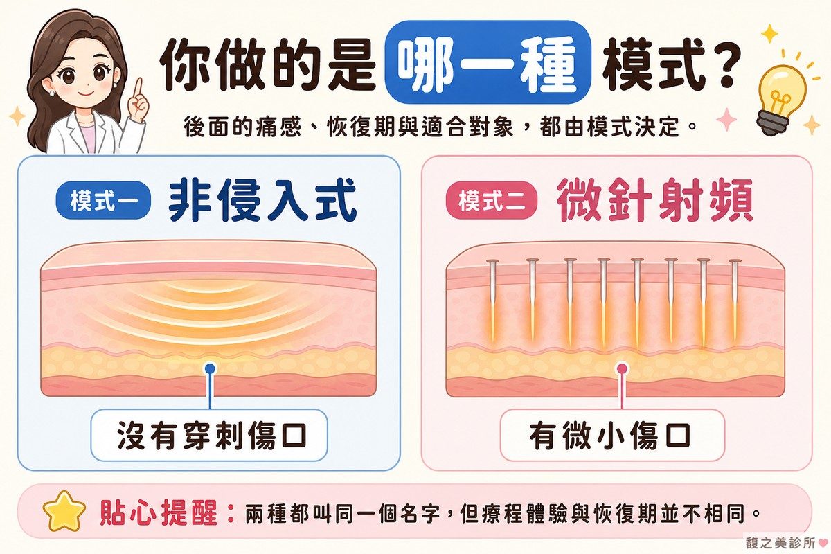 時空E電波的兩種主要模式——非侵入式射頻與微針射頻