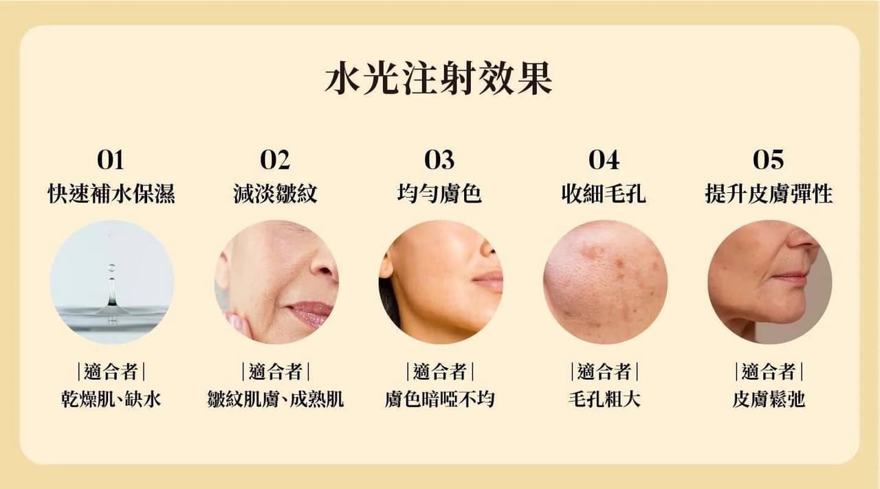水光注射的五大效果與適合對象圖解：包含快速補水改善乾燥缺水、減淡皺紋修護成熟肌、均勻暗啞膚色、收細粗大毛孔，以及提升鬆弛皮膚的彈性。