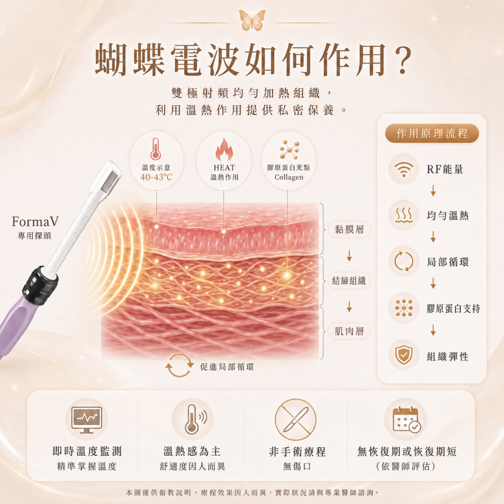 蝴蝶電波作用原理圖，左側探頭發出射頻能量作用於黏膜層、結締組織與肌肉層，標示溫度約 40-43°C；右側流程為 RF能量、均勻溫熱、局部循環、膠原蛋白支持、組織彈性，下方四項特點為即時溫度監測、以溫熱感為主、非手術無傷口、恢復期短