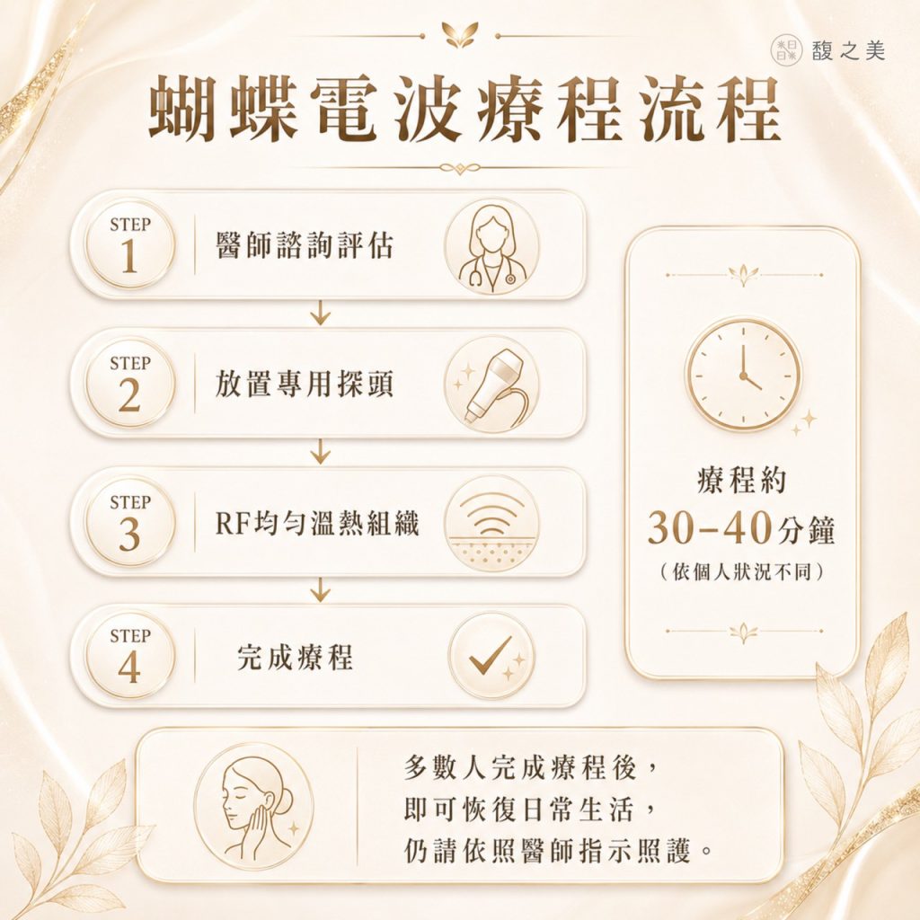 蝴蝶電波療程流程圖卡，四個步驟依序為醫師諮詢評估、放置專用探頭、RF均勻溫熱組織、完成療程，右側標示療程約 30-40 分鐘（依個人狀況不同）