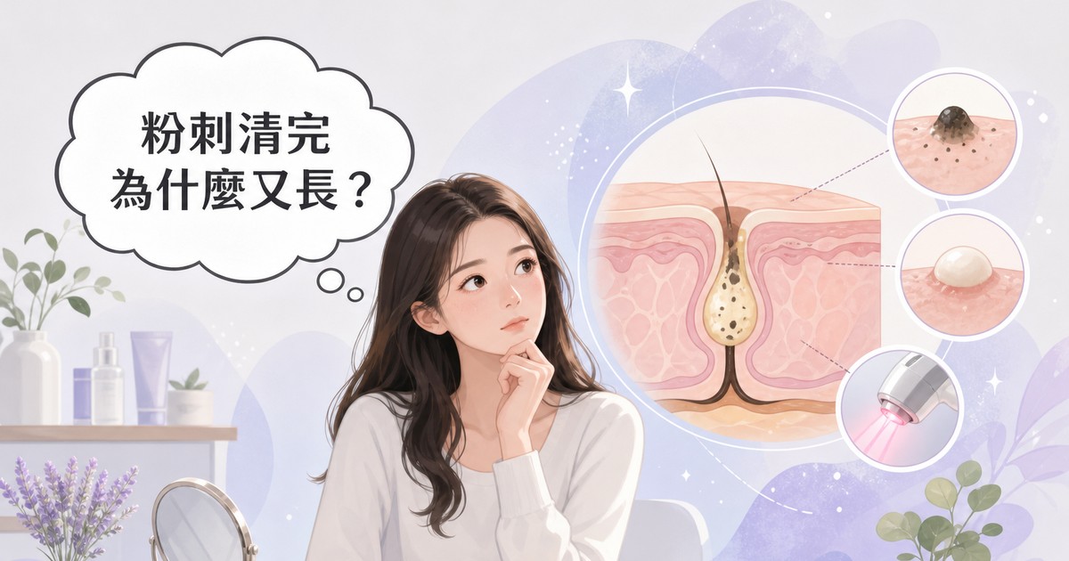 粉刺是什麼？成因、正確清除步驟與雷射光療選項一次看懂