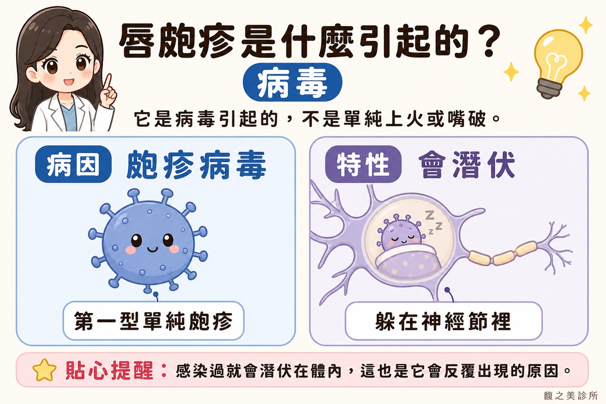 衛教資訊圖，頂端標題寫「唇皰疹是什麼引起的？」。左卡標「病因·皰疹病毒」，畫一個圓形病毒角色，帶小圓點眼睛，標註「第一型單純皰疹」；右卡標「特性·會潛伏」，畫一條神經節圖案，裡面一隻小病毒角色在睡覺，標註「躲在神經節裡」。