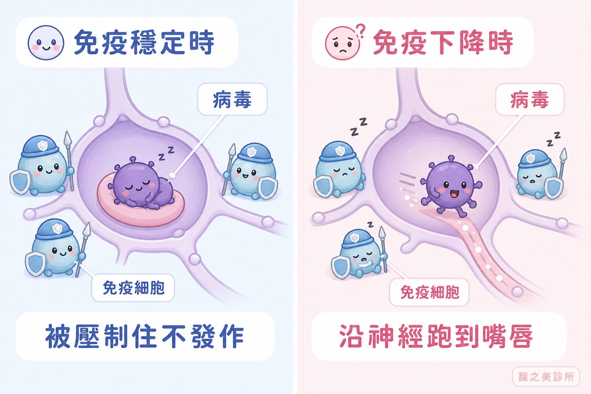 左右對照的機轉插圖。左邊標「免疫穩定時」，畫神經節剖面，被擬人化的病毒小角色在裡面安穩睡覺，外圍幾個免疫細胞小角色精神地站崗，下方結論寫「被壓制住不發作」；右邊標「免疫下降時」，畫同樣的剖面，站崗的免疫細胞小角色打起瞌睡，病毒小角色醒來往外移動，下方結論寫「沿神經跑到嘴唇」。