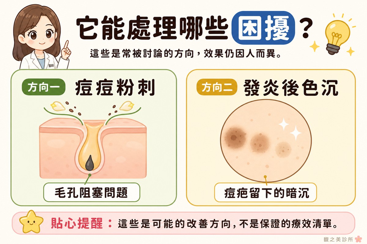 衛教資訊圖，頂端標題寫「它能處理哪些困擾？」。左卡標「方向一·痘痘粉刺」，畫毛孔剖面，出口的油脂與角質被溫和地推開，標註「毛孔阻塞問題」；右卡標「方向二·發炎後色沉」，畫圓形皮膚特寫，上面幾個褐色小點顏色漸淡，標註「痘疤留下的暗沉」。