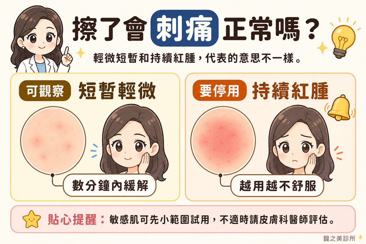 衛教資訊圖，頂端標題寫「擦了會刺痛正常嗎？」。左卡標「可觀察·短暫輕微」，畫圓形皮膚特寫，帶一點很淡的紅色調，旁邊一個平靜的表情，標註「數分鐘內緩解」；右卡標「要停用·持續紅腫」，畫圓形皮膚特寫，紅色調較明顯，旁邊一個提醒鈴鐺，標註「越用越不舒服」。