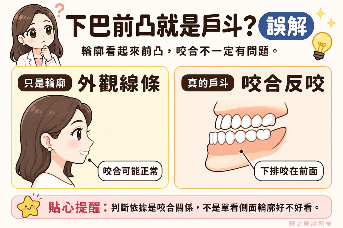 衛教資訊圖，頂端標題寫「下巴前凸就是戽斗？」。左卡標「只是輪廓·外觀線條」，畫Q版側臉，下巴線條較明顯但牙齒咬合正常，標註「咬合可能正常」；右卡標「真的戽斗·咬合反咬」，畫咬合側面圖，下排牙齒明顯咬在上排前方，標註「下排咬在前面」。