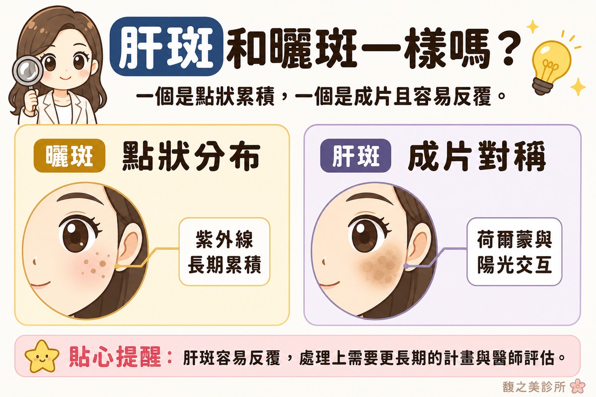 衛教資訊圖，頂端標題寫「肝斑和曬斑一樣嗎？」。左卡標「曬斑·點狀分布」，畫圓形臉頰特寫，上面幾個界線清楚的褐色小點，標註「紫外線長期累積」；右卡標「肝斑·成片對稱」，畫圓形臉頰特寫，兩頰有一片邊界模糊的褐色斑片，標註「荷爾蒙與陽光交互」。