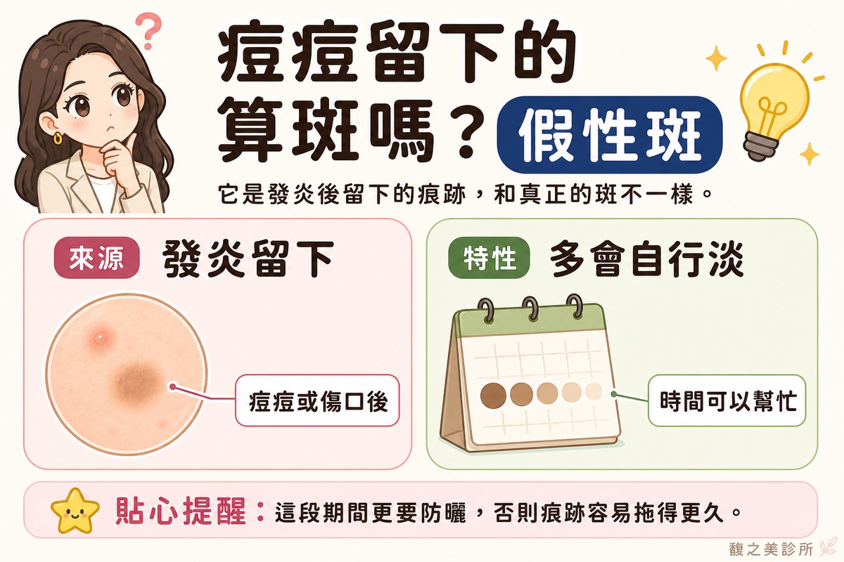 衛教資訊圖，頂端標題寫「痘痘留下的算斑嗎？」。左卡標「來源·發炎留下」，畫圓形皮膚特寫，一顆痘痘退去後留下褐色印子，標註「痘痘或傷口後」；右卡標「特性·多會自行淡」，畫日曆搭配一個顏色逐漸變淡的褐色圓點，標註「時間可以幫忙」。