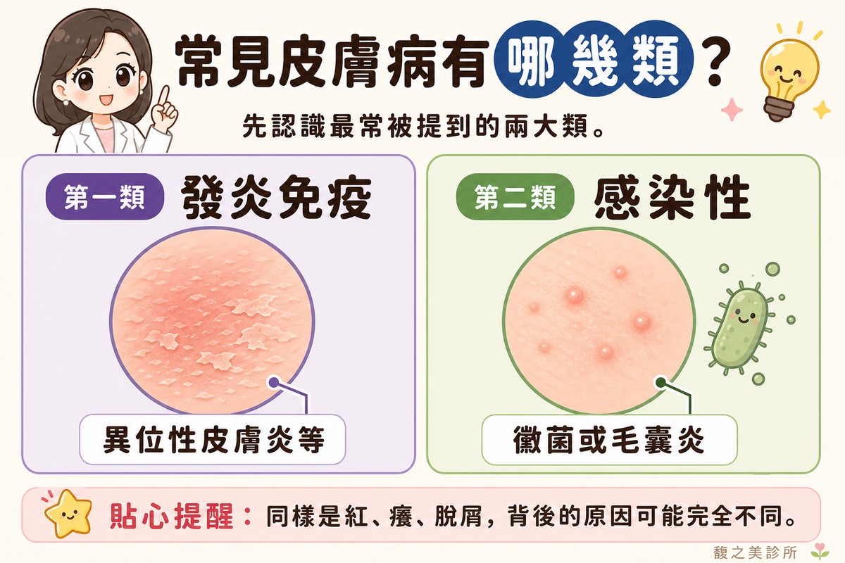 衛教資訊圖，頂端標題寫「常見皮膚病有哪幾類？」。左卡標「第一類·發炎免疫」，畫圓形皮膚特寫，表面帶乾燥脫屑與淡紅色調，標註「異位性皮膚炎等」；右卡標「第二類·感染性」，畫圓形皮膚特寫，上面有幾個小丘疹，旁邊一個細菌小圖案，標註「黴菌或毛囊炎」。