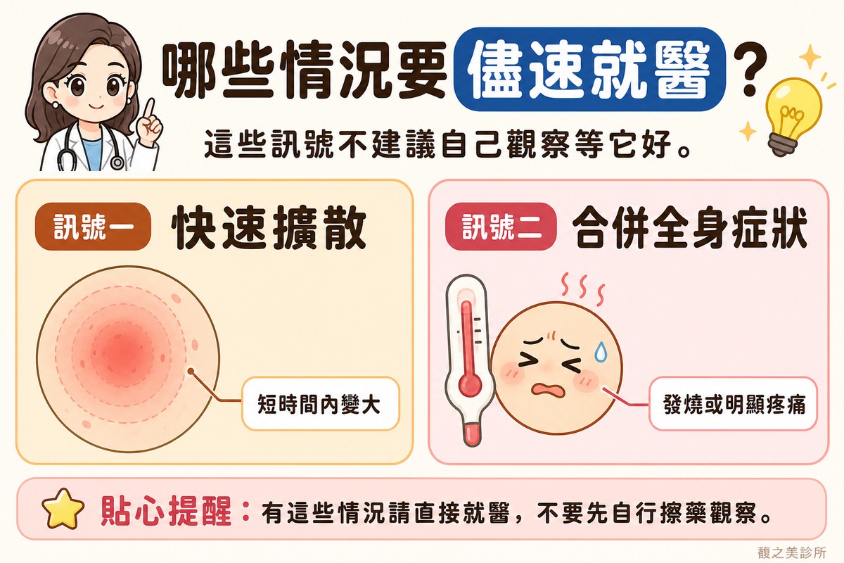 衛教資訊圖，頂端標題寫「哪些情況要儘速就醫？」。左卡標「訊號一·快速擴散」，畫圓形皮膚特寫，紅疹範圍以同心圓向外擴大，標註「短時間內變大」；右卡標「訊號二·合併全身症狀」，畫一支體溫計搭配一個表情不適的圓形臉，標註「發燒或明顯疼痛」。
